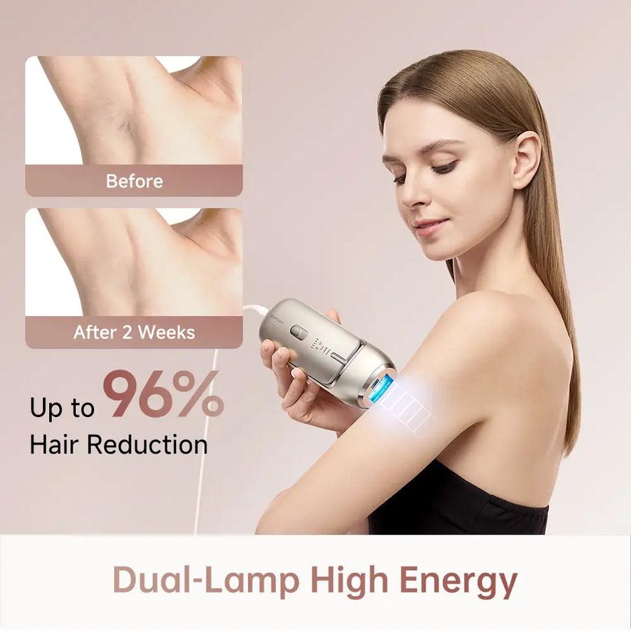 HAIR REMOVAL DEVICE IPL NOVA/AHR01-GOLD DREAME